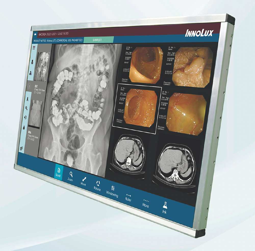 ●群創將展出30吋6M彩色診斷用醫療顯示器,兼具2500:1高對比、1300nits高亮度特性,大尺寸可同時顯示多種醫學影像,有效提高醫護工作效率。圖/群創提供 image